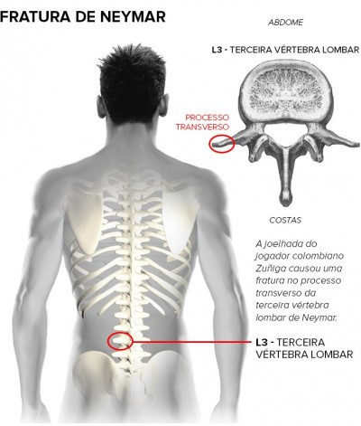 Infogrfia de GloboSporte.com